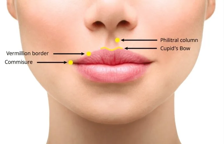 lipfiller